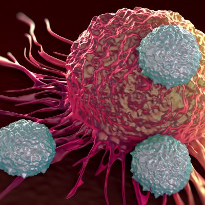 T-cells attacking a tumor cell.